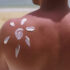 view-man-applying-lotion-sunburn-skin-beach